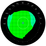 normal corneal topography