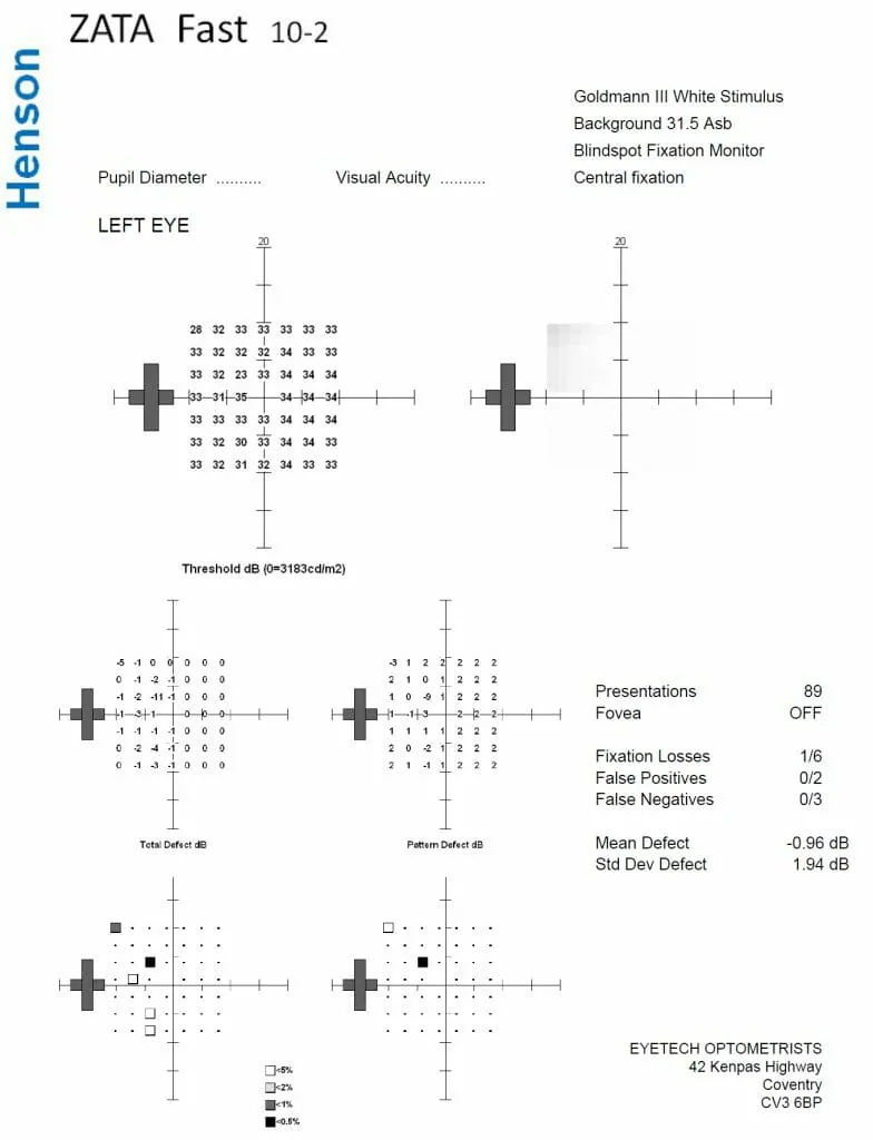 fields ft visual fields test
