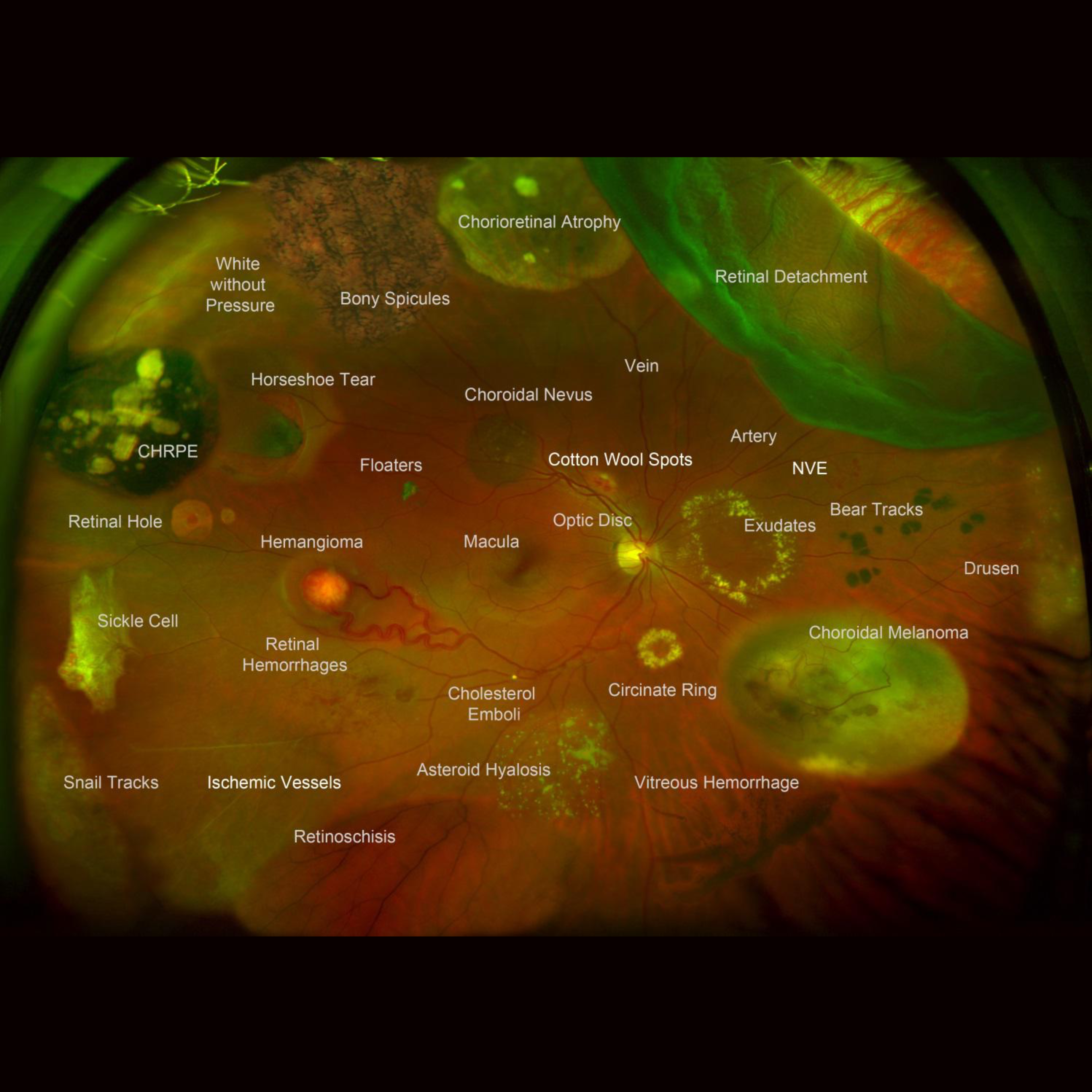 Eyetech optomap